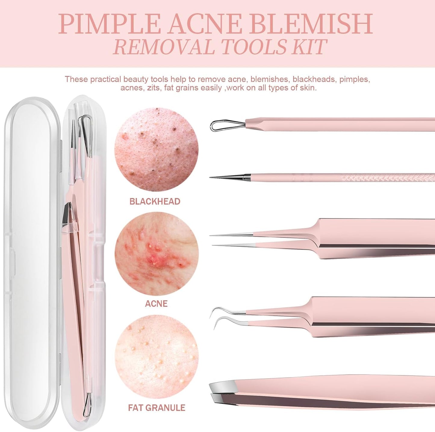 Herbionyx Blackhead & Pore Extractor Tool Set