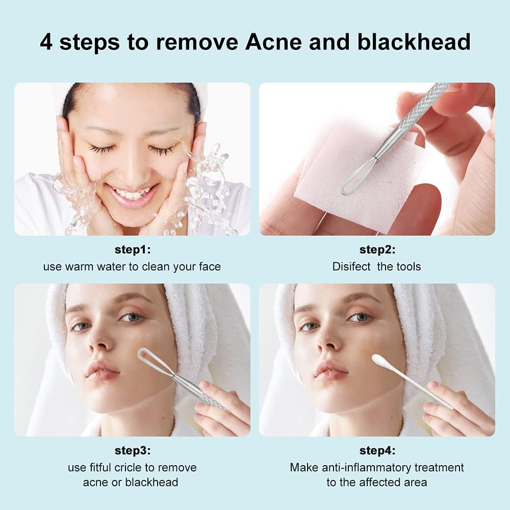 Herbionyx Professional Blackhead Extractor Tool