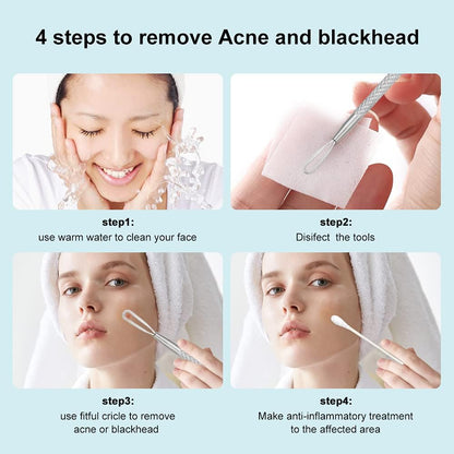 Herbionyx Professional Blackhead Extractor Tool